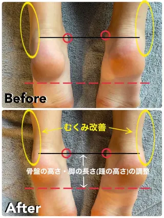 鍼灸整骨院Refine所属・鍼灸 Refineのその他イメージ