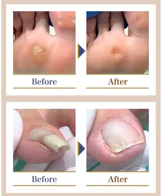 ネイル 巻き爪補正店越谷店所属・巻き爪補正店 越谷店のネイルデザイン