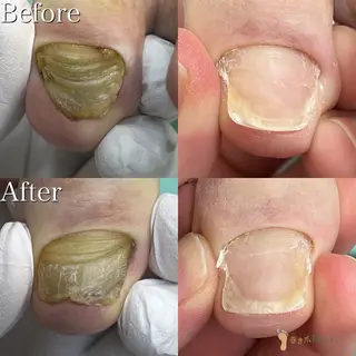 東京巻き爪アカデミー所属・東京巻き爪 アカデミーのエステ・リラクイメージ