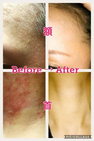 Bène Soin du Esthétique所属・逵中 元香のエステ・リラクイメージ