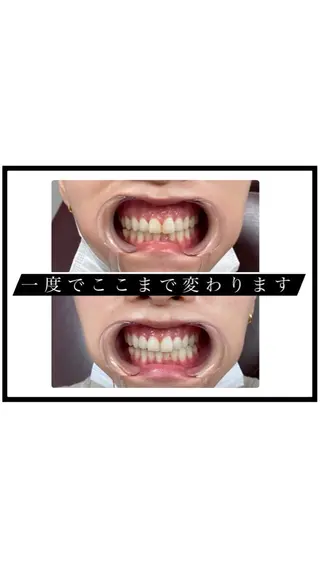 beauty salon AIbelle所属・結果重視の痩身エステ 🕊アイベル　みずきのエステ・リラクイメージ