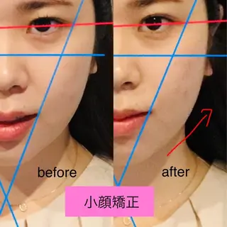 チキバン美容鍼灸整体 サロン心斎橋店のエステ・リラクイメージ