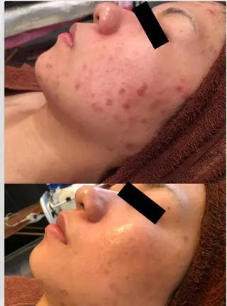 アクア ティアラのエステ・リラクイメージ