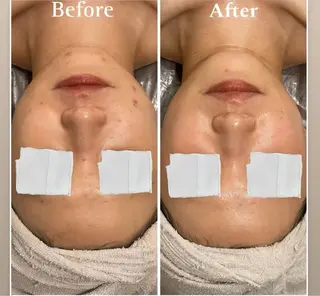 mimosa心斎橋所属・山﨑 諒のエステ・リラクイメージ