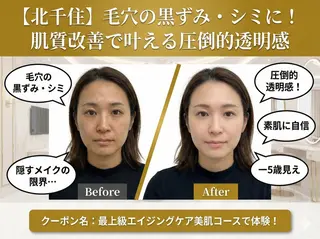 【歴13年】劇的小顔 D rマジックタッチのエステ・リラクイメージ