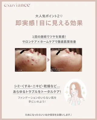 M. lisyelのエステ・リラクイメージ