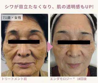 Binosu所属・エンダモロジー BINOSUのその他イメージ