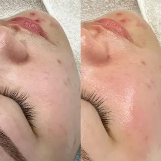 Lei beauty salon所属・松ヤニワックス専門/ 梅田/Leiのエステ・リラクイメージ