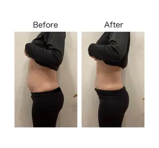 小顔サロンSharp …腸調整よもぎ蒸しのエステ・リラクイメージ