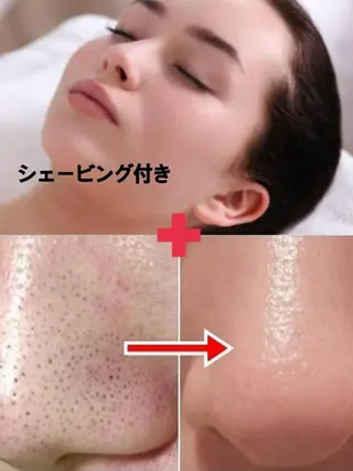 肌ケア＆毛穴洗浄 Cheriのエステ・リラクイメージ