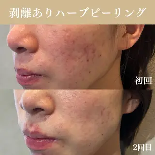 Oncebell. Bodymake&beautysalon所属・Oncebell. ワンベルのエステ・リラクイメージ
