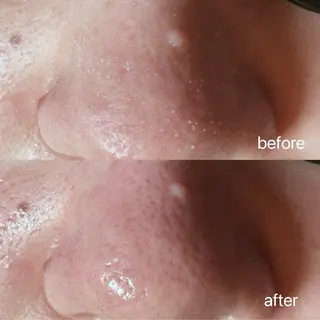 ケアサロン Titieのマツエク・マツパデザイン