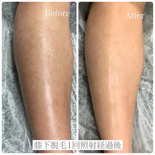 DISINI  SPA所属・DISINISPA 脱毛/フェイシャルのエステ・リラクイメージ