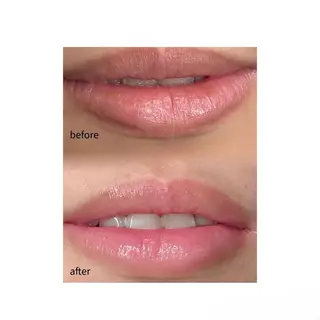 レティティア【Laetitia】所属・レティティア秋葉原店 Yoshizawaのエステ・リラクイメージ