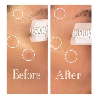 デトックス美容専門サロンｐｅｏｎｙ所属・デトックス美容専門 サロンｐｅｏｎｙのエステ・リラクイメージ