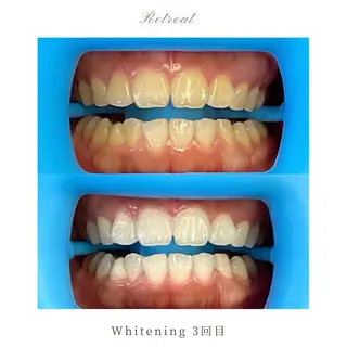 Retreatリトリート所属・歯科医院提携 Retreatのその他イメージ