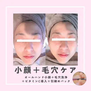 |ピーリング・毛穴| soina神楽坂のエステ・リラクイメージ