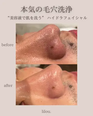 hue.所属・LAND YUKAのエステ・リラクイメージ