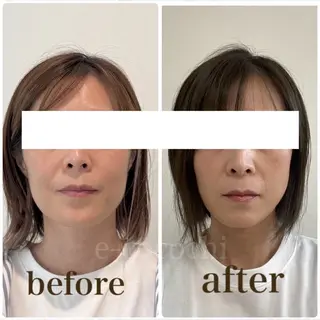 小顔と ヘッドスパのお店のエステ・リラクイメージ