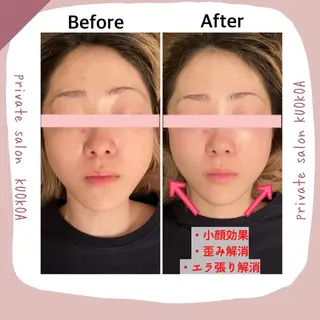 中目黒  整体 小顔 KUOKOAのエステ・リラクイメージ