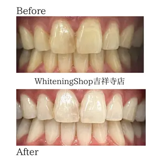 ホワイトニング ショップ吉祥寺店のエステ・リラクイメージ