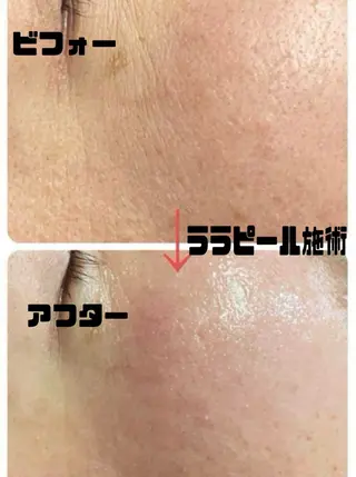 山崎 陽子のエステ・リラクイメージ