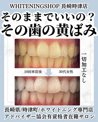 ホワイトニングショップ時津店所属・ホワイトニング ショップ長崎時津店のその他イメージ