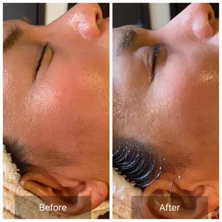 Mandarin Orange所属・毛穴から始める肌メン テマンダリンオレンジのエステ・リラクイメージ