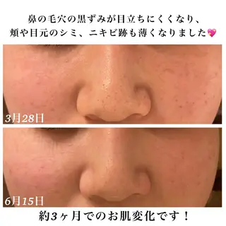 Bellesthe （ベルエステ）のエステ・リラクイメージ