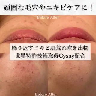 Ginza Charerのエステ・リラクイメージ