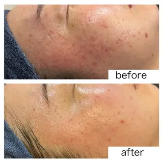 leolo武蔵浦和 肌質改善＆脱毛のエステ・リラクイメージ