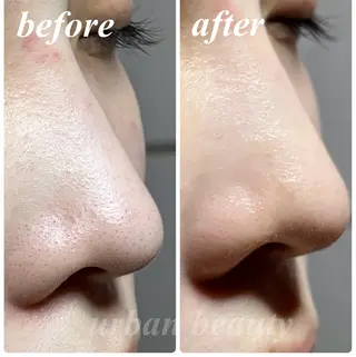 結果重視｜毛穴エステ ｜友綱理恵のエステ・リラクイメージ