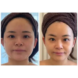 小顔コルギ＆オイル アンドエスのエステ・リラクイメージ