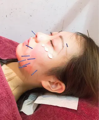 美容鍼灸女性専用 りんご鍼灸治療院のエステ・リラクイメージ