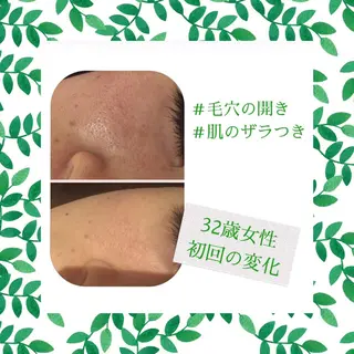 ミディアム カラー パーマ ヘアアレンジ メンズ キッズ ネイル マツエク・マツパ ニキビ・肌質改善専門 ♡人生が変わるサロンのエステ・リラクイメージ