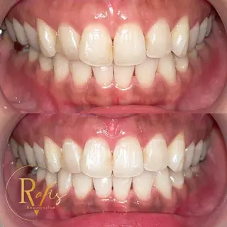 新石切ravis - ラヴィス -のその他イメージ