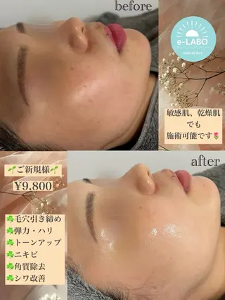 e-LABO こいずみのエステ・リラクイメージ