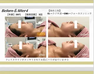 nico sideのエステ・リラクイメージ