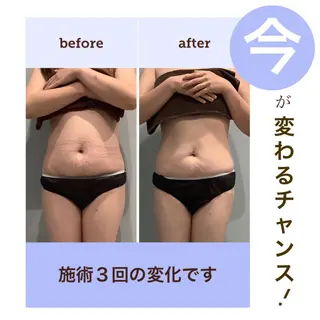 エステサロン JURISのエステ・リラクイメージ