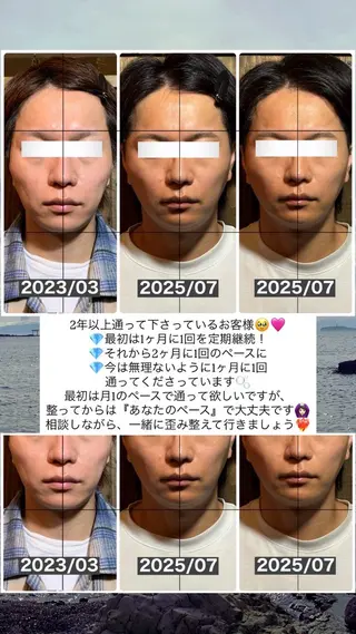 💎後悔させない小顔 矯正💎イトヤマ🌱のエステ・リラクイメージ
