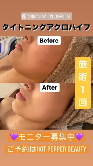 Remina clinical salon所属・ハイフ美肌専門 Remina.c.sのエステ・リラクイメージ