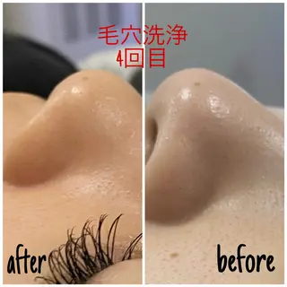 毛穴洗浄・痩身・脱毛 /アルカンジュのエステ・リラクイメージ