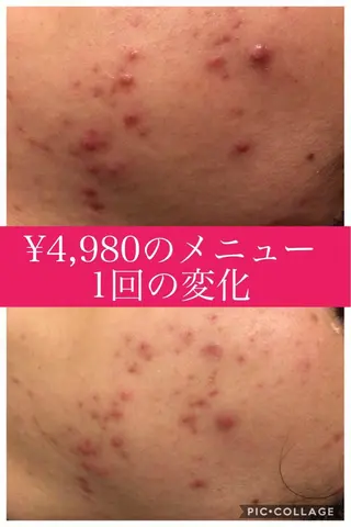 ミディアム カラー パーマ ヘアアレンジ メンズ キッズ ネイル マツエク・マツパ ニキビ・肌質改善専門 ♡人生が変わるサロンのエステ・リラクイメージ