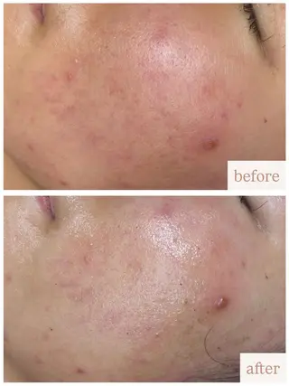 uni. abeのエステ・リラクイメージ