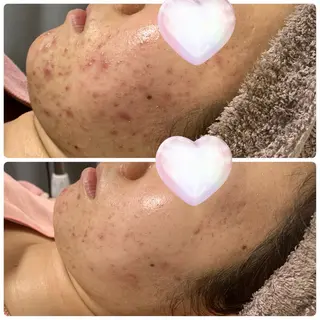 M.riche エムリシェのエステ・リラクイメージ