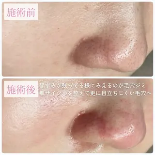 毛穴肌質ケアサロン Yourmeユアミーのエステ・リラクイメージ