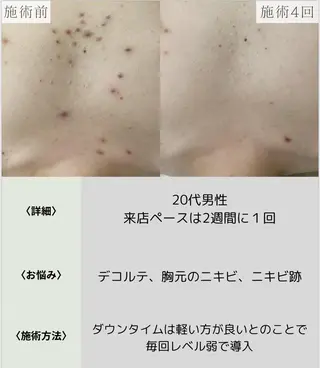 脱毛・眉毛・フェイス サロンN久留米店の眉毛・アイブロウイメージ