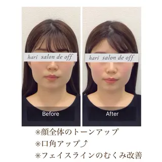 整体×美容鍼灸 鍼灸師Miyanoのエステ・リラクイメージ