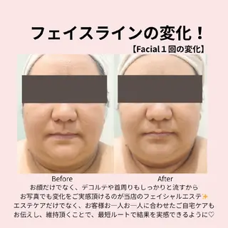 PRETTIEST SHINE所属・フェイシャル/ボディ /ブライダル山田浩子のエステ・リラクイメージ