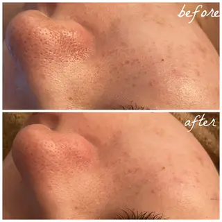 メンズ メナード岐阜市茜部 杉浦のエステ・リラクイメージ